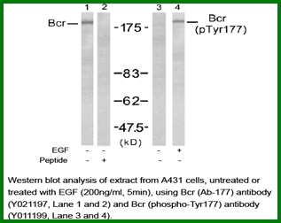 Anti-Bcr (Ab-177)