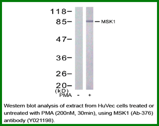 Anti-MSK1 (Ab-376)