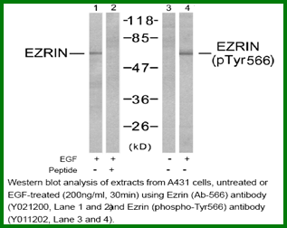 Anti-Ezrin (Ab-566)