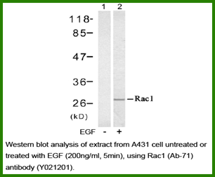 Anti-Rac1 (Ab-71)