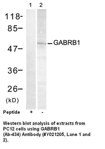 Anti-GABRB1 (Ab-434)