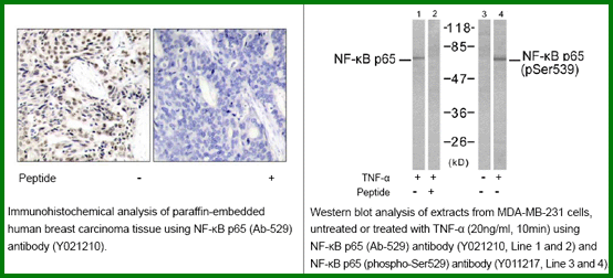 Anti-NF-kB p65 (Ab-529)