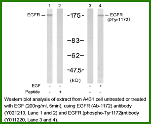 Anti-EGFR (Ab-1172)