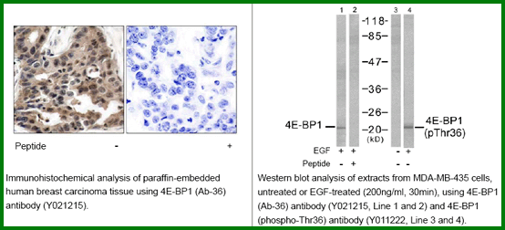 Anti-4E-BP1(Ab-36)