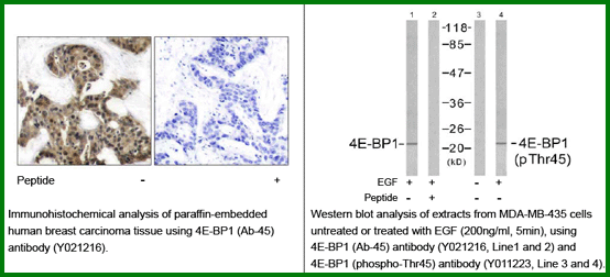 Anti-4E-BP1(Ab-45)