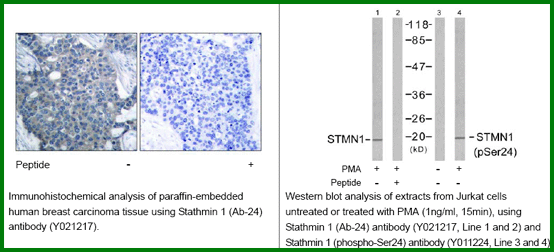 Anti-Stathmin 1(Ab-4)