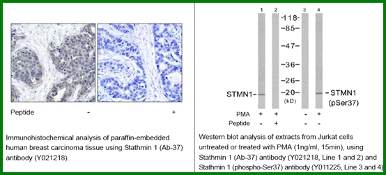Anti-Stathmin 1 (Ab-37)