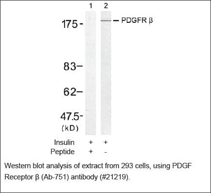 Anti-PDGF Receptor &beta; (Ab-751)