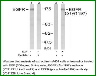 Anti-EGFR (Ab-1197)