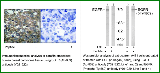 Anti-EGFR (Ab-869)