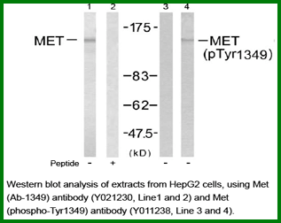 Anti-Met (Ab-1349)