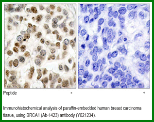 Anti-BRCA1 (Ab-1423)