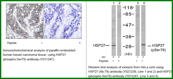 Anti-HSP27 (Ab-78)