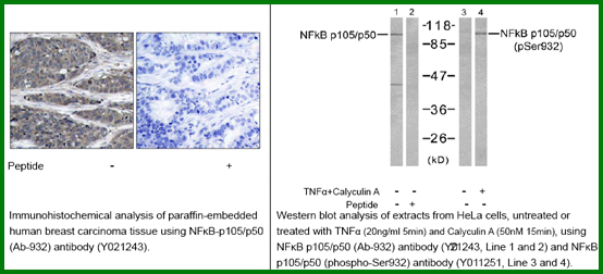 Anti-NF-kB p105-p50(Ab-932)