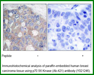 Anti-p70 S6 Kinase (Ab-421)