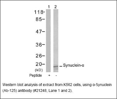 Anti-&beta;-Synuclein (Ab-125)