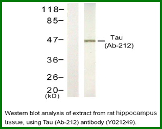 Anti-Tau (Ab-212)