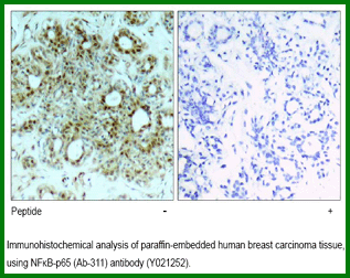 Anti-NF-&kappa;B p65 (Ab-311)