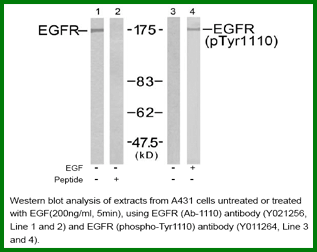 Anti-EGFR (Ab-1110)
