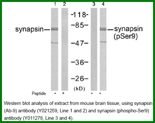 Anti-Synapsin(Ab-9)