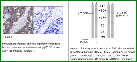 Anti-p70 S6 Kinase (Ab-411)