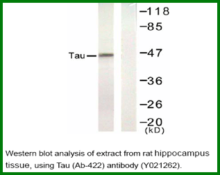 Anti-Tau (Ab-422)