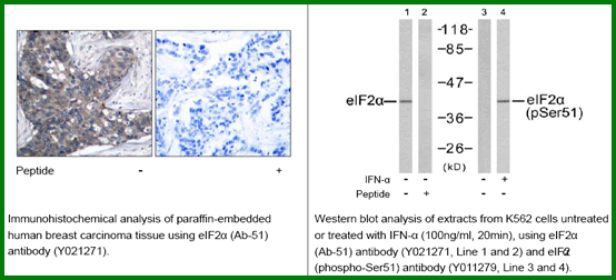 Anti-eIF2&alpha; (Ab-51)