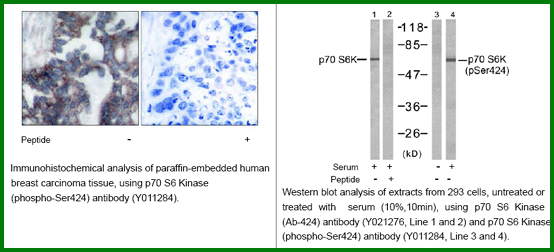 Anti-p70 S6 Kinase (Ab-424)