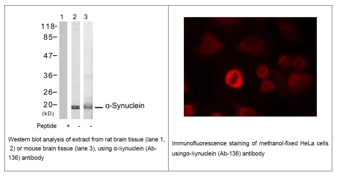 Anti-&szlig;-Synuclein (Ab-136)