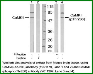Anti-CaMKII (Ab-286)