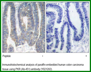 Anti-PKR (Ab-451-