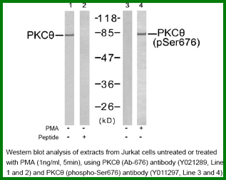 Anti-PKC&theta; (Ab-676)
