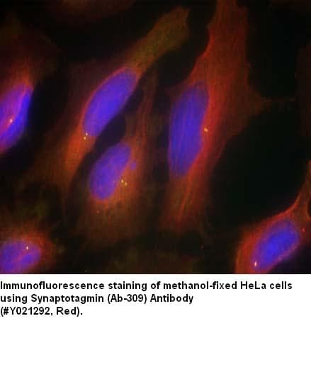 Anti-Synaptotagmin(Ab-309)