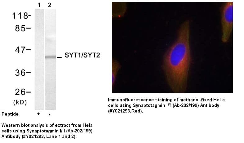 Anti-Synaptotagmin I/II (Ab-202/199)