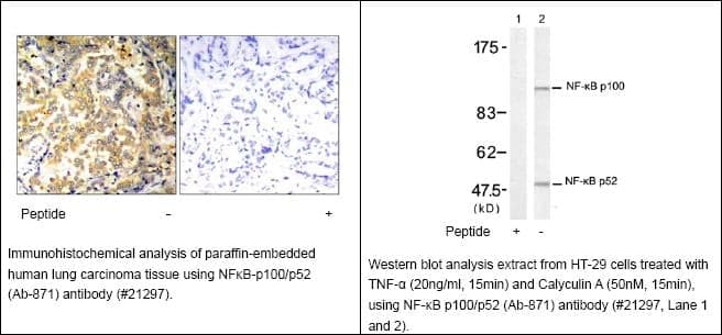 Anti-NF&kappa;B-p100/p52 (Ab-871)