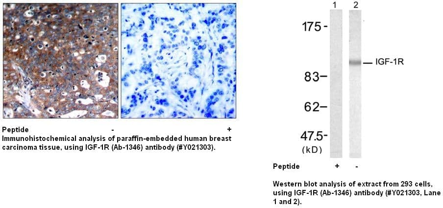 Anti-IGF-1R (Ab-1346)