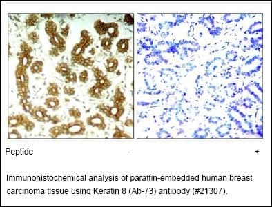 Anti-Keratin 8 (Ab-73)