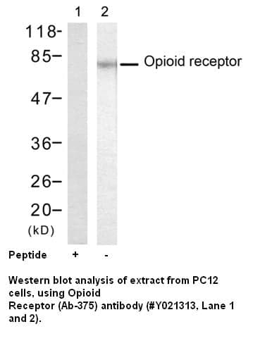 Anti-Opioid Receptor (Ab-375)