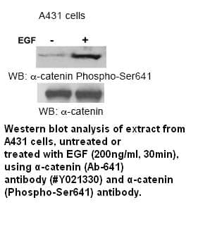 Anti-ß-catenin (Ab-641)