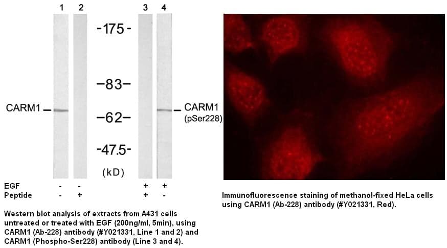 Anti-CARM1 (Ab-228)