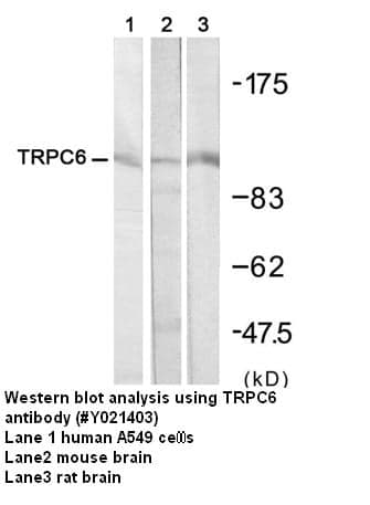 Anti-TRPC6