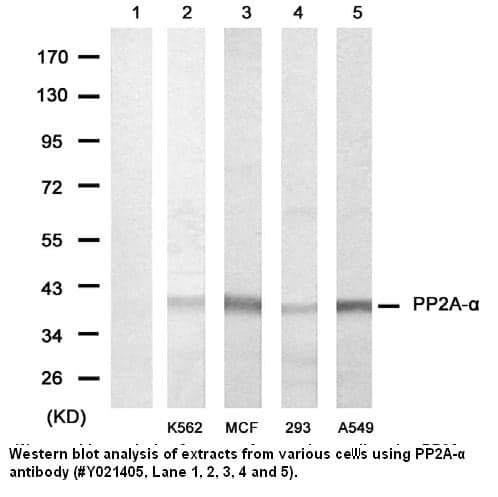 Anti-PP2A-&beta;