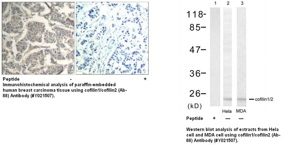 Anti-Cofilin1/cofilin2 (Ab-88)