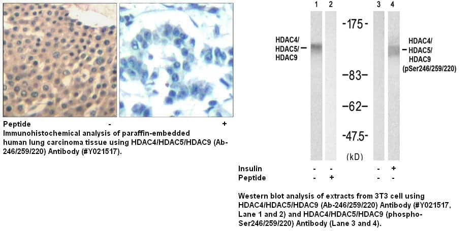 Anti-HDAC4/HDAC5/HDAC9 (Ab-246/259/220)