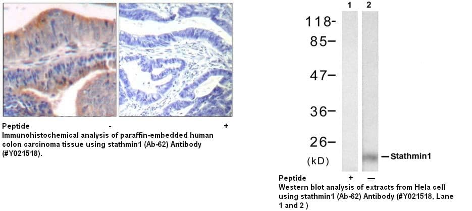 Anti-stathmin1 (Ab-62)