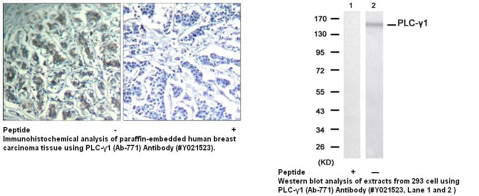 Anti-PLC-&gamma;1 (Ab-771)