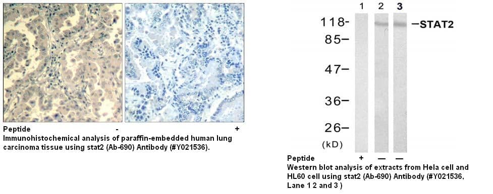 Anti-Stat2 (Ab-690)