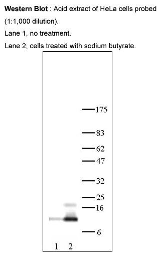 Anti-Histone H4 tetra acetyl