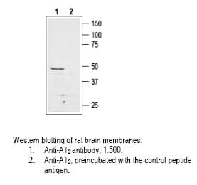 Anti-Angiotensin II Receptor (AT2 Receptor) (extracellular)
