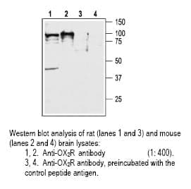 Anti-Orexin Receptor 2